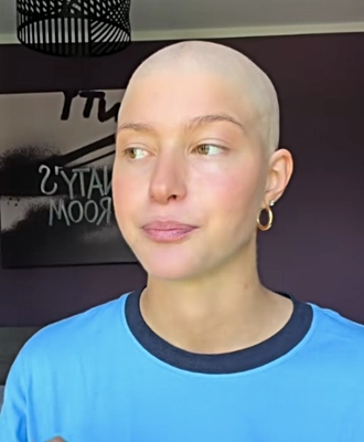 Natalia Paragoni, come procede la terapia? Parla lei: “Ci sono dei grandi progressi”